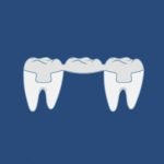 Dental Services - Bridges