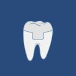 Dental Services - Crowns